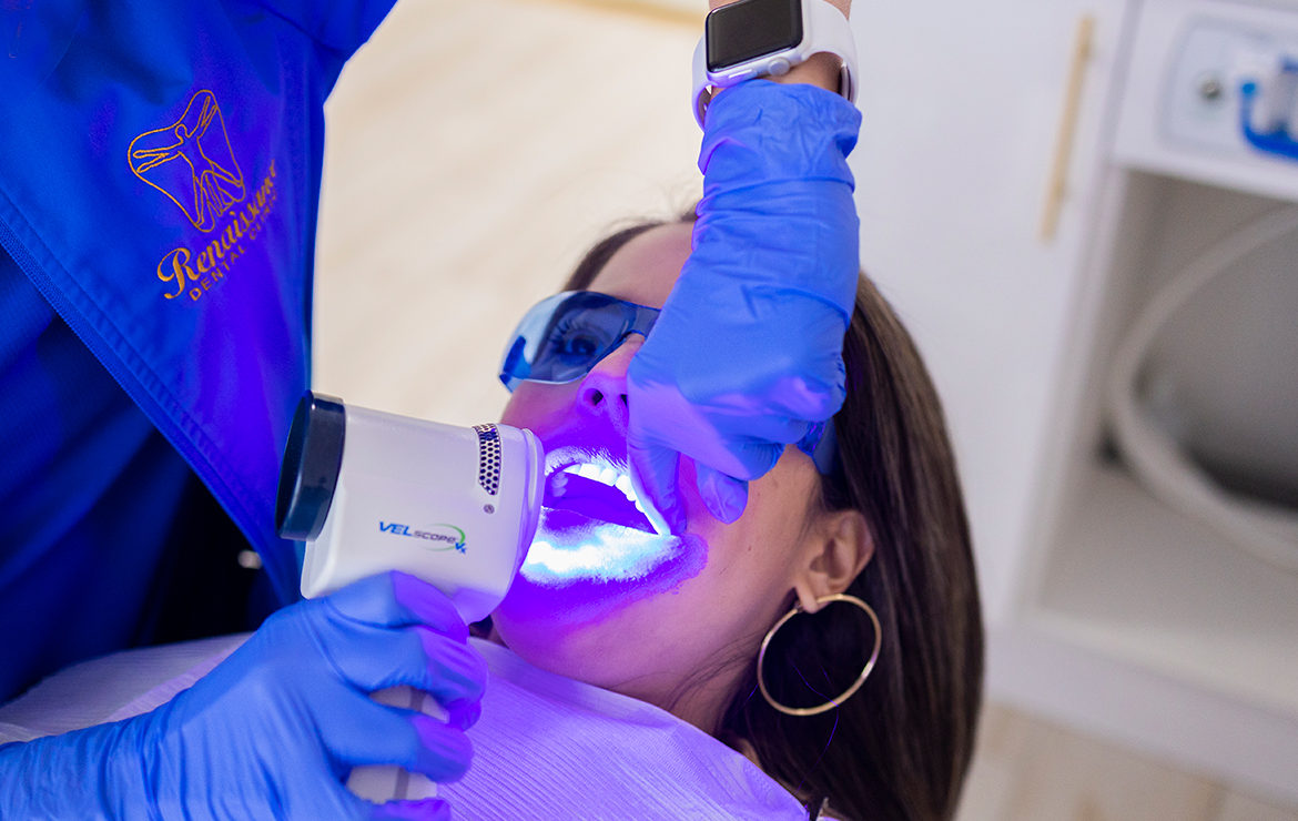 What is tooth whitening?
