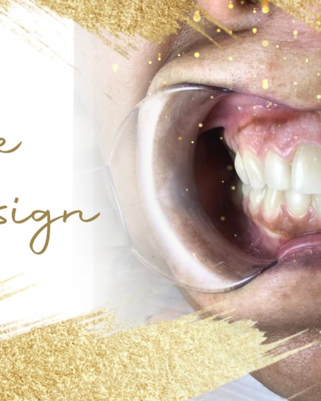 SMILE DESIGN: Más que diseñar tu sonrisa, cambiamos tu vida