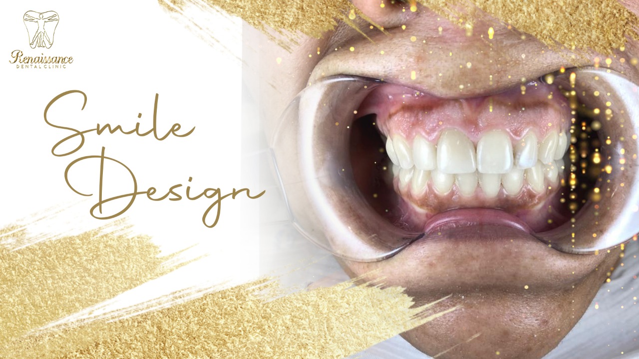 WhatsApp Image 2021-03-10 at 3.10.08 PM (2)