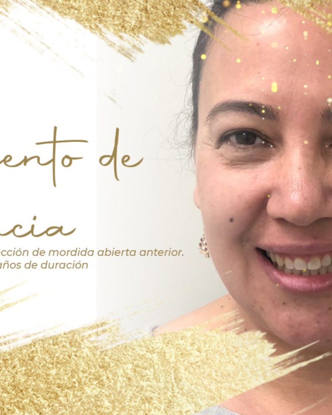 TRATAMIENTO DE ORTODONCIA