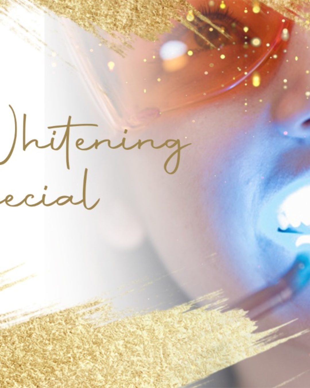 ZOOM WHITENING SPECIAL OFFER