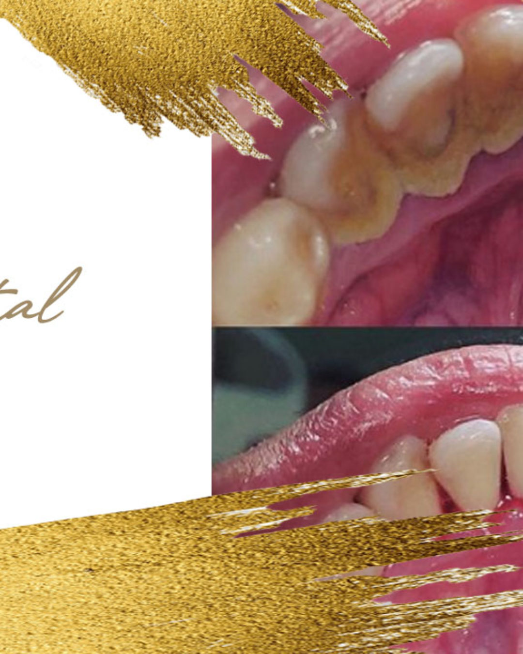 Limpieza Dental Doctora Elena Solis